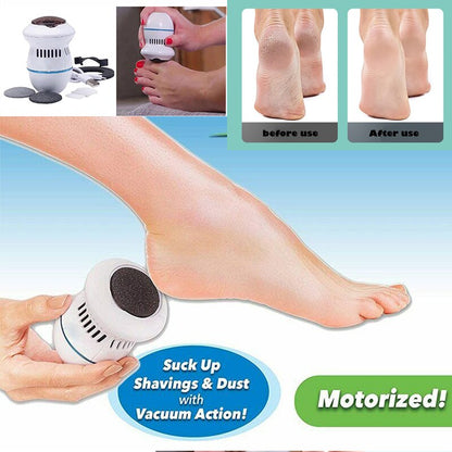 Electric Foot Grinder Exfoliates