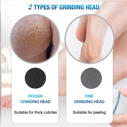 Electric Foot Grinder Exfoliates