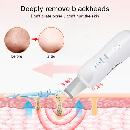 Ultrasonic Skin Scrubber Deep Face